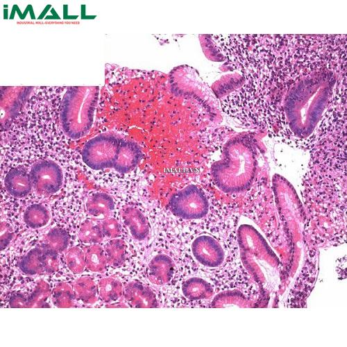 Hóa chất Mayer's hemalum dùng cho kính hiển vi (Chai nhựa 1l) Merck 1092491000