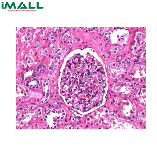 Hóa chất Hematoxylin solution modified acc. to Gill III cho kính hiển vi (Chai nhựa 1 L) Merck 1051741000